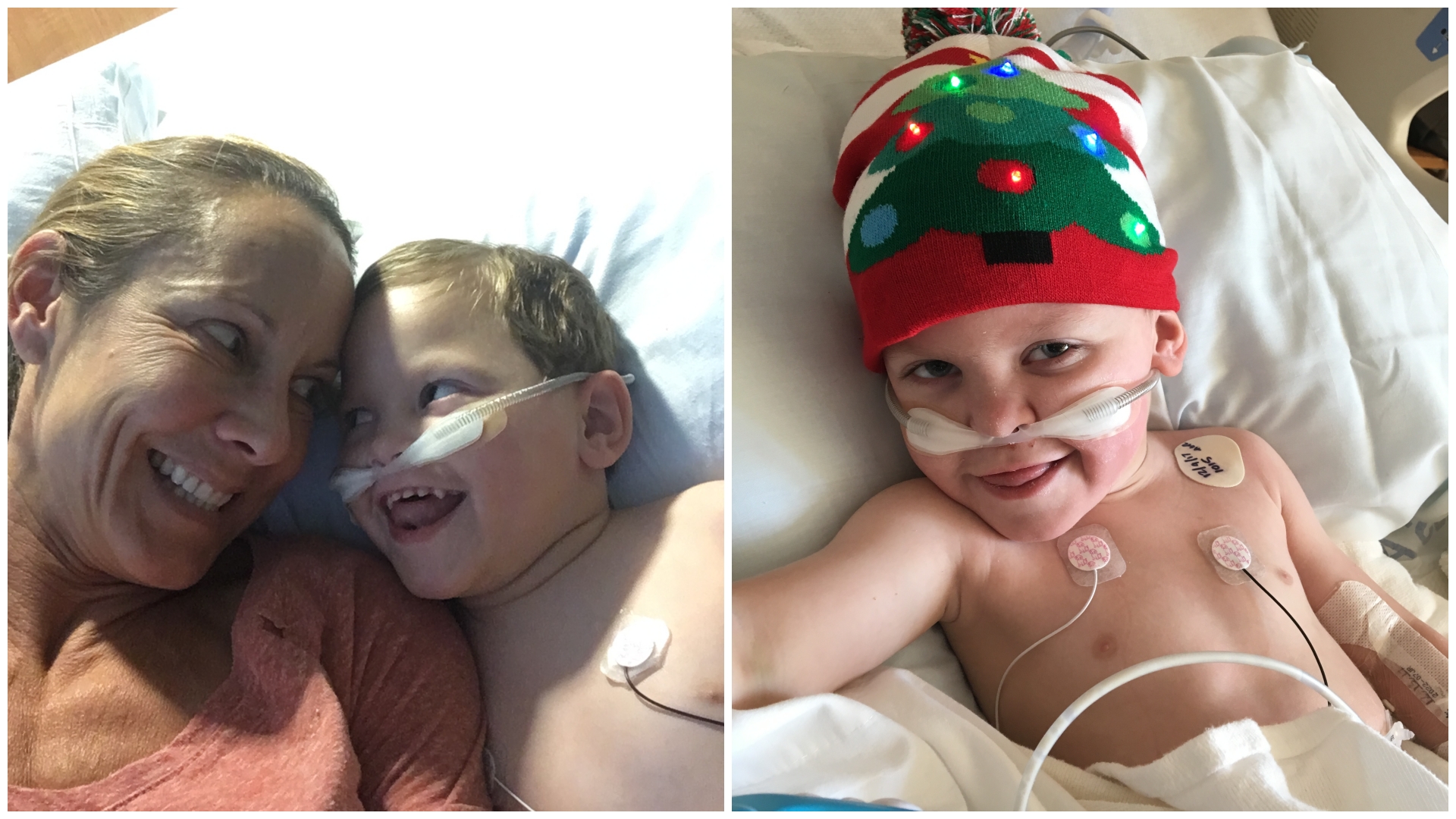 Even after trying several anti-epileptic medications, Jake’s seizures persisted. But when the team at Atrium Health Levine Children’s suggested he try the ketogenic diet, everything quickly changed for this happy-go-lucky 5-year old. 