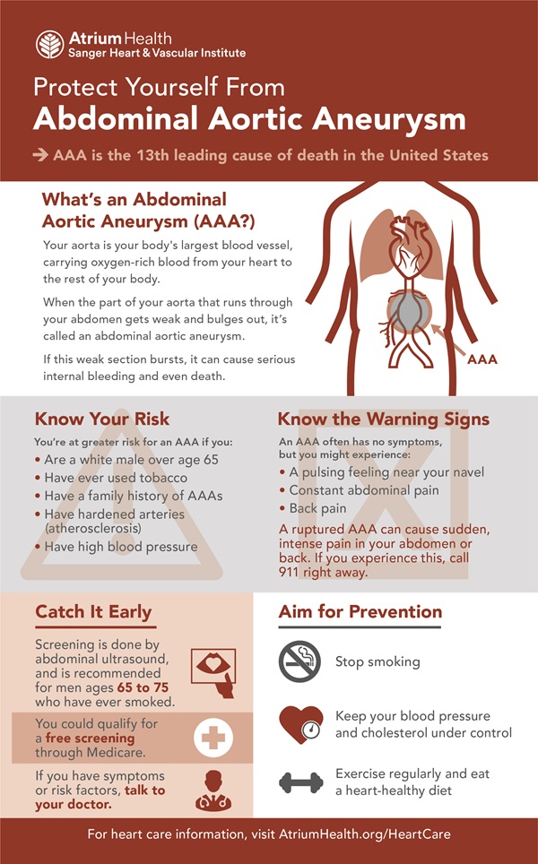 Abdominal aortic aneurysm infographic