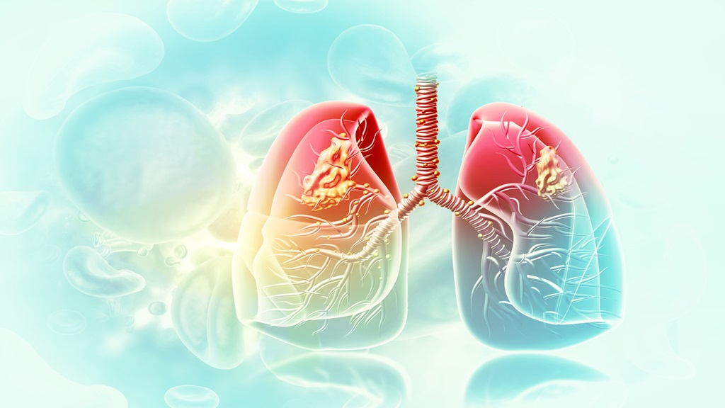 graphic of lungs