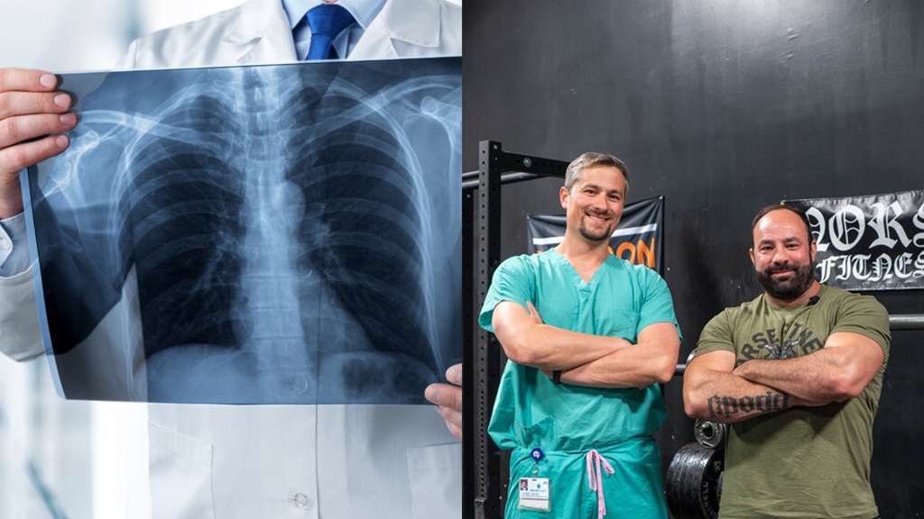 x-ray photo to the left with a patient photo on the right