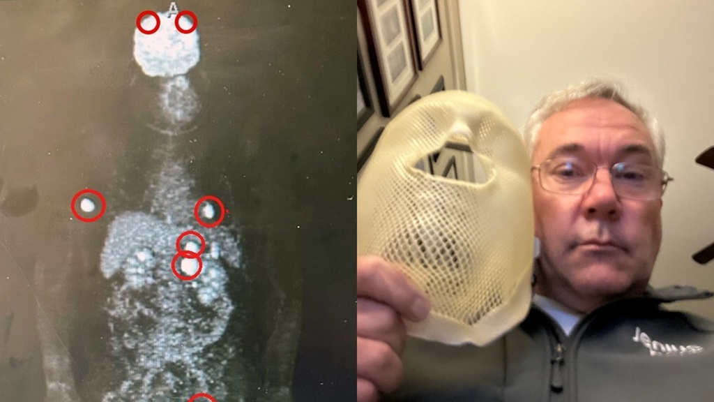 Man with brain scan mask