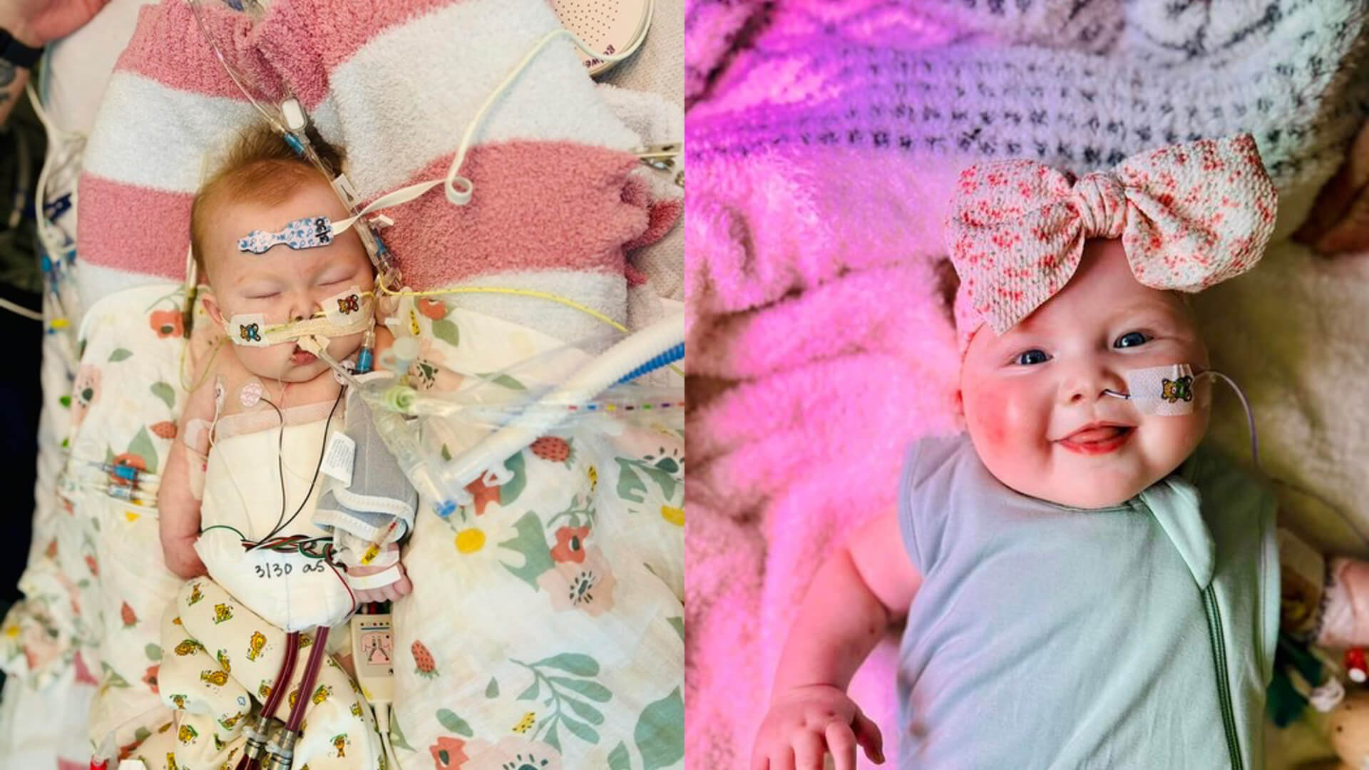 Two photos of a baby side-by-side.